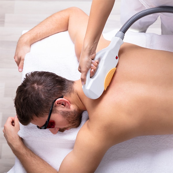 Male laser hair removal treatments